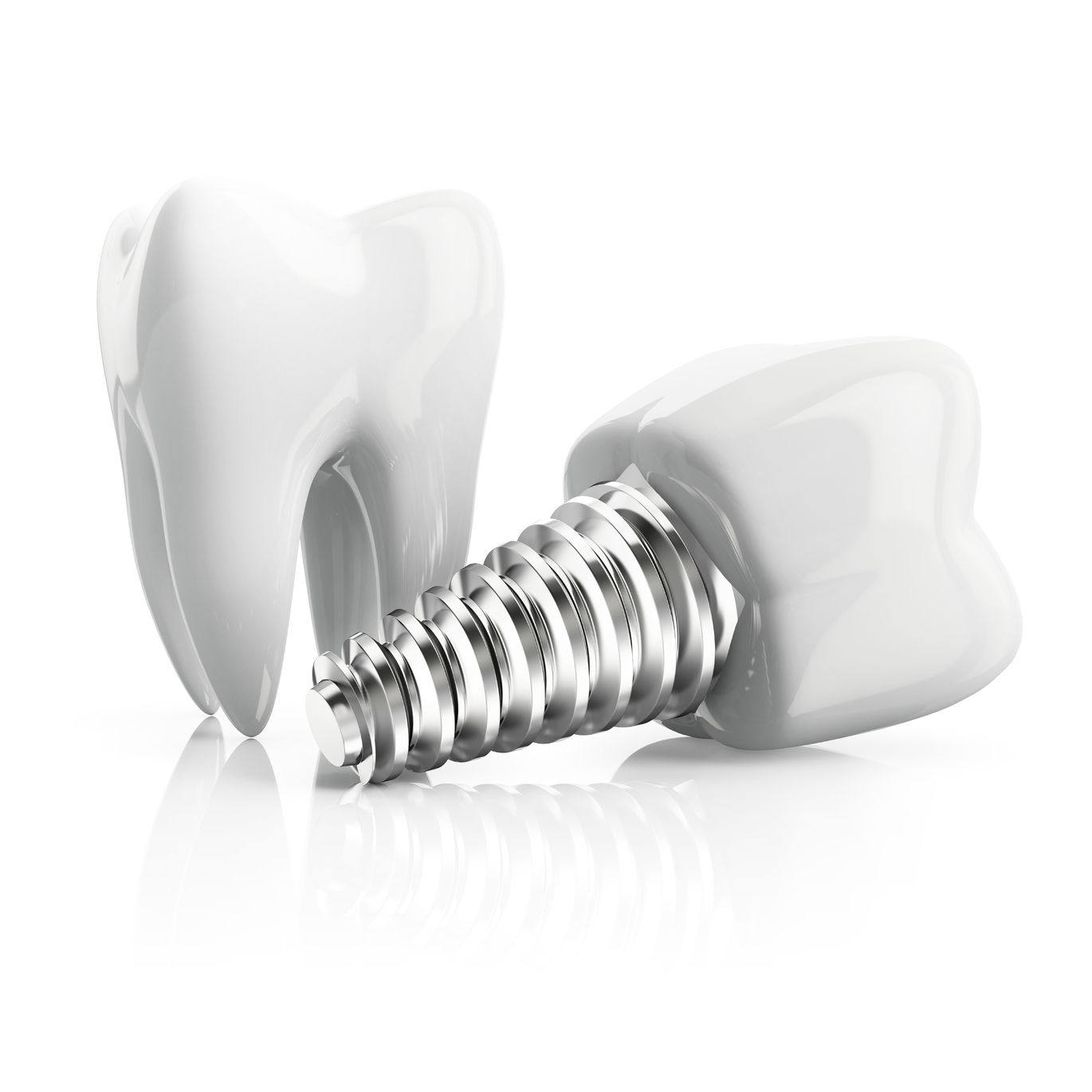 Dental implants