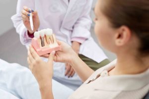 Read more about the article Are Dental Implants As Good As Natural Teeth?