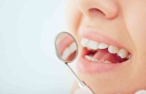 Read more about the article Dental Care: Why Is Dental Health So Important?
