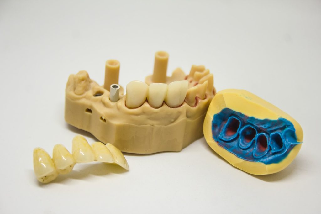 tooth bonding procedures