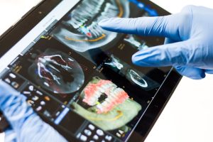 dental bone graft procedure recovery