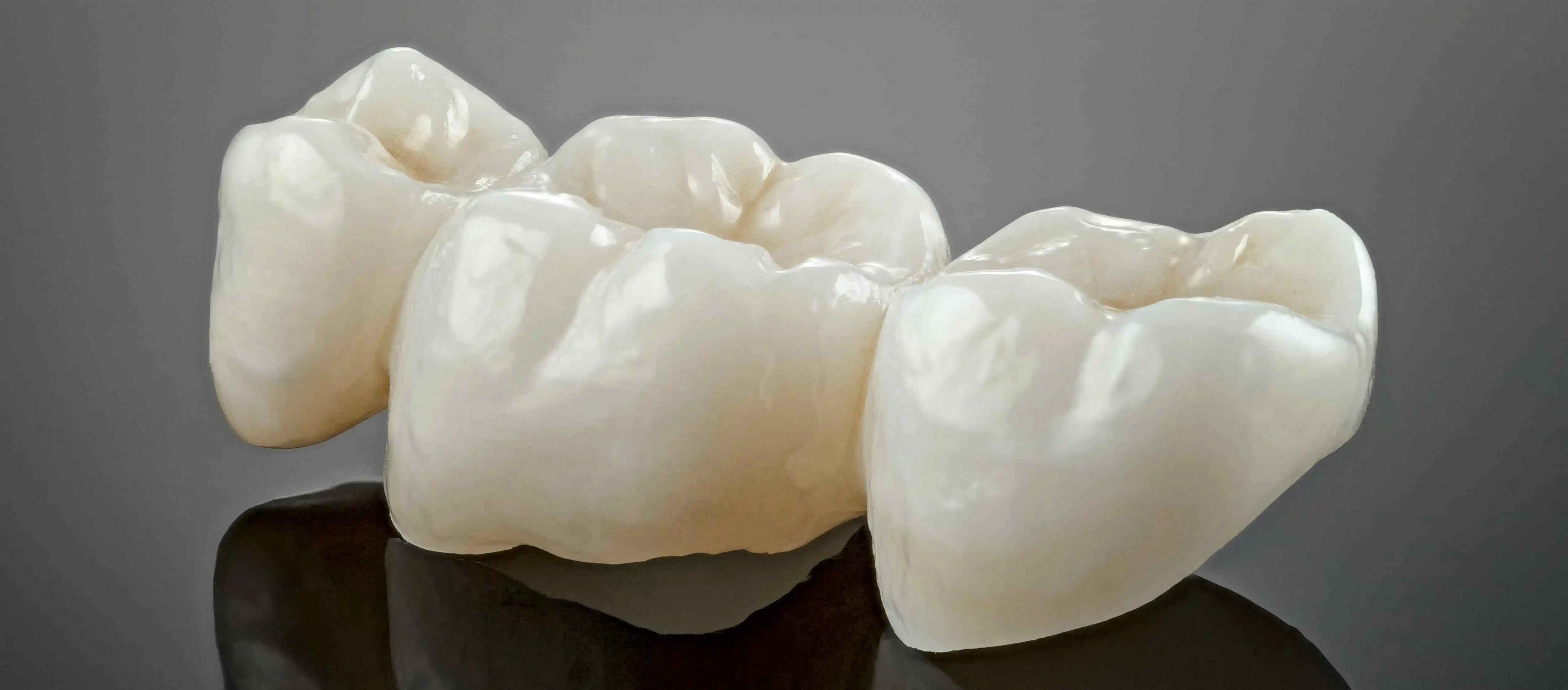 Read more about the article How Dental Crowns Can Give You a Smile Transformation