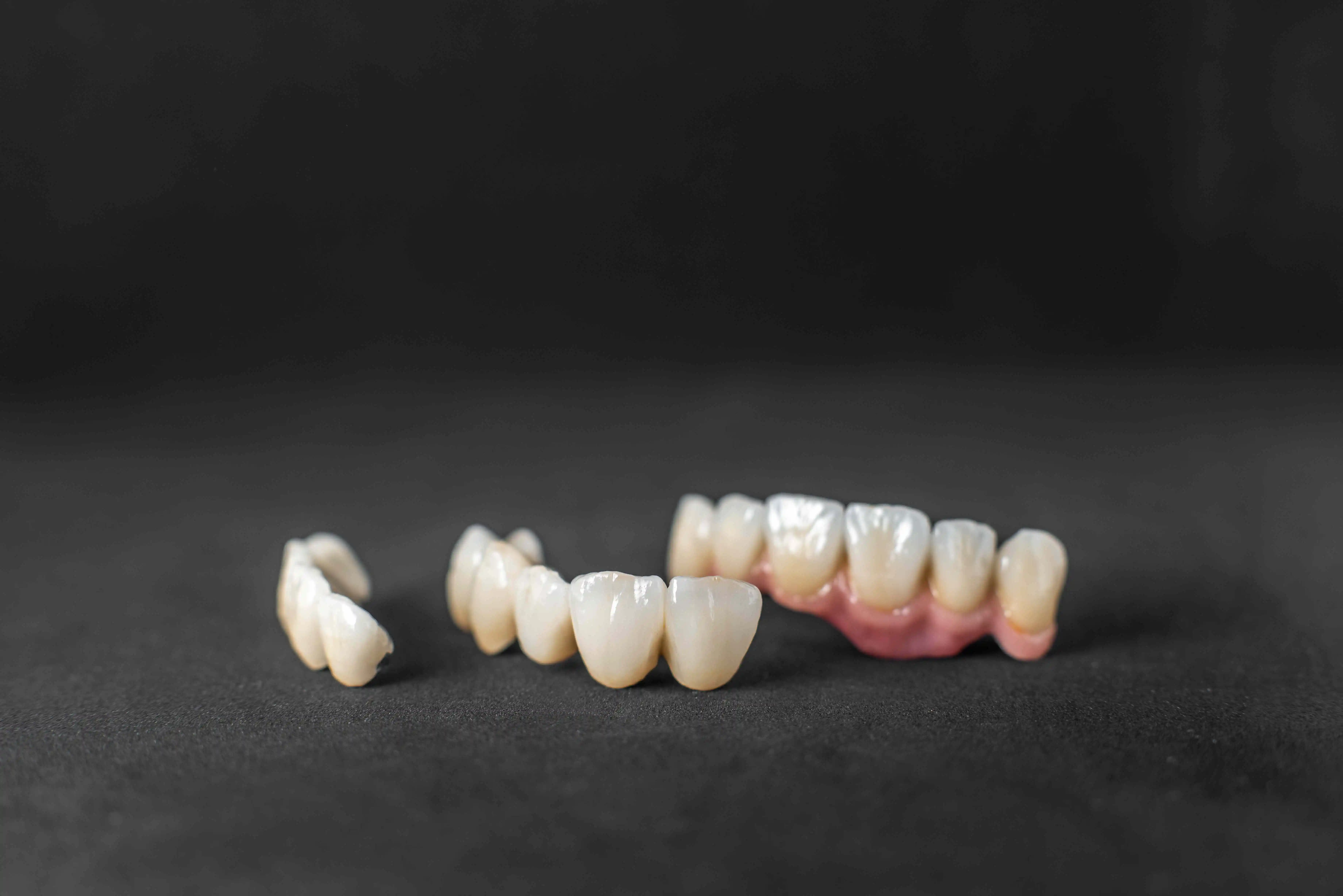 Types of Dental Crowns 