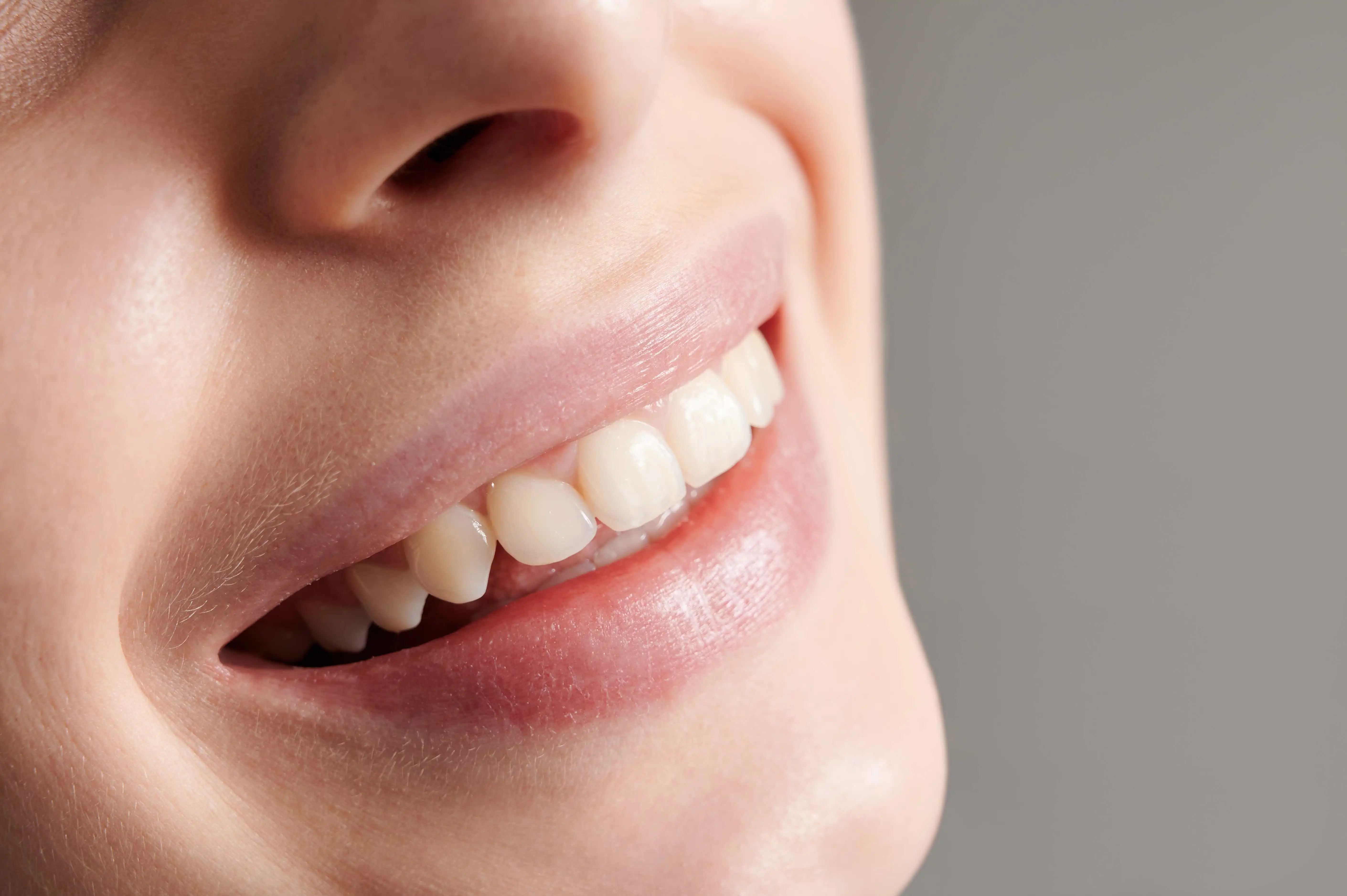You are currently viewing Which Should I Choose – Composite Bonding or Dental Veneers?