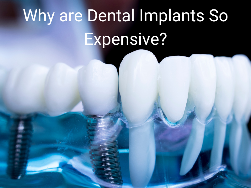 Why are Dental Implants So Expensive