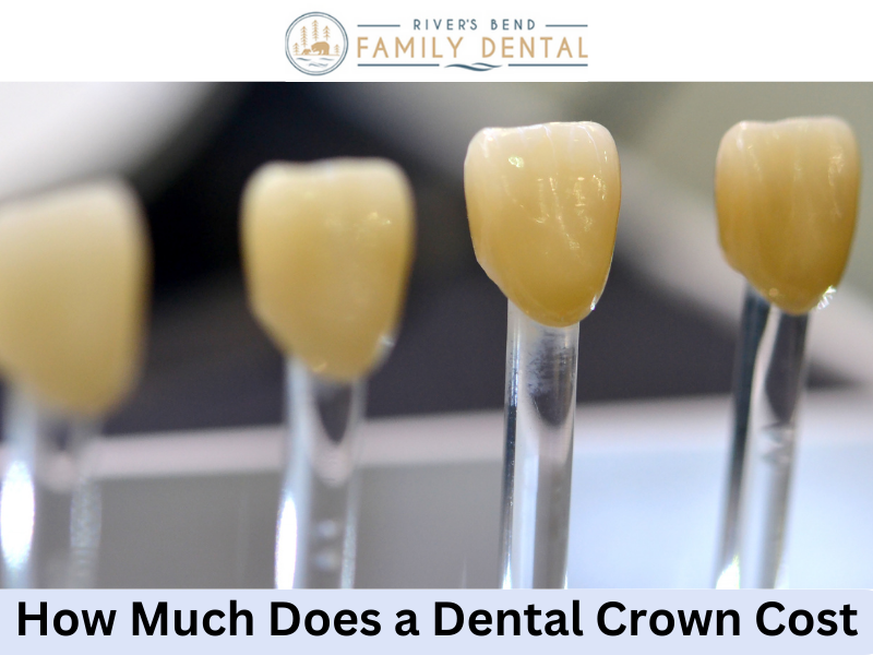 How Much Does a Dental Crown Cost