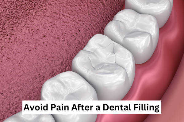 Tips to Avoid Pain After a Dental Filling