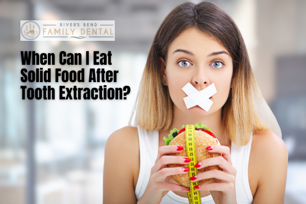 You are currently viewing When Can I Eat Solid Food After Tooth Extraction?