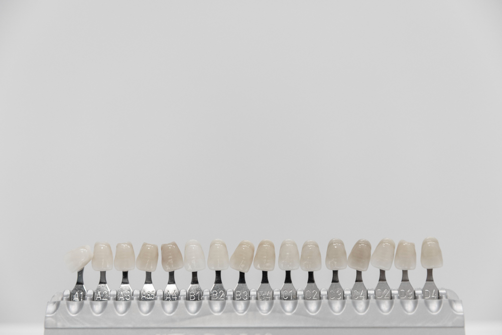 Dental Crowns Types