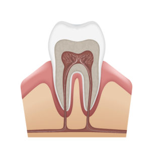 exposed tooth root