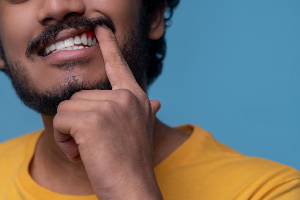 Read more about the article Bleeding Gums While Flossing? Causes, Prevention & When to Worry