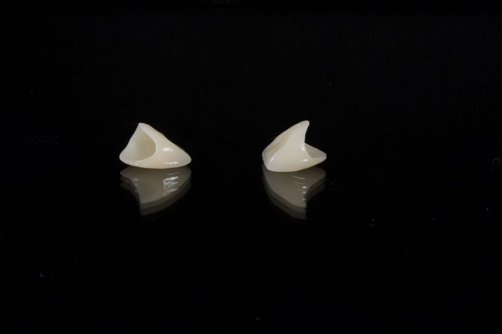 crown for tooth