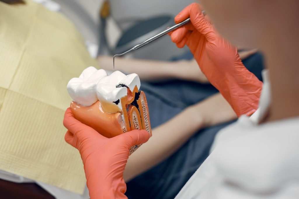 root canal procedure