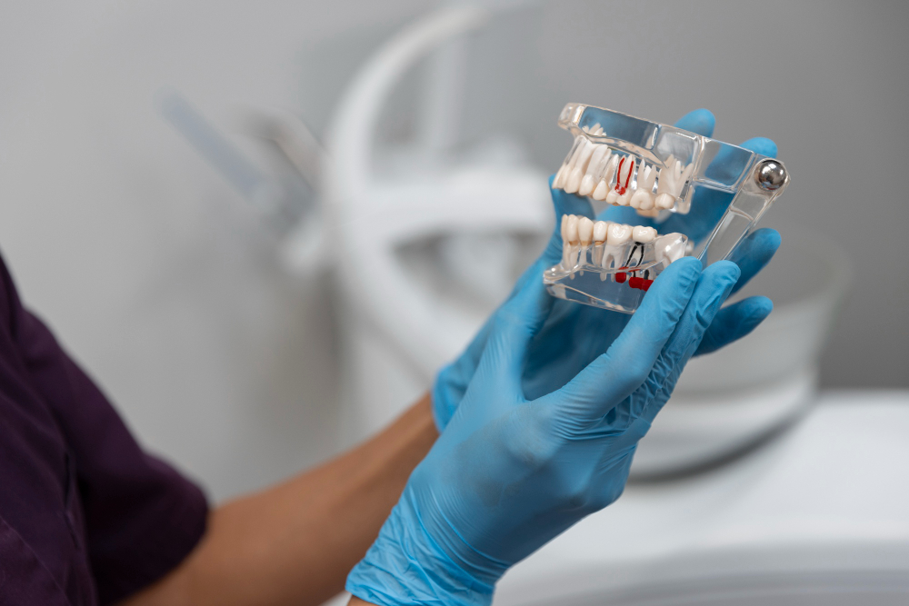 implant supported bridge