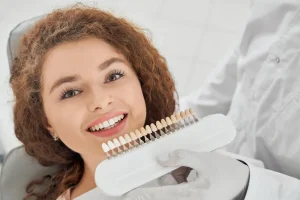 composite veneers